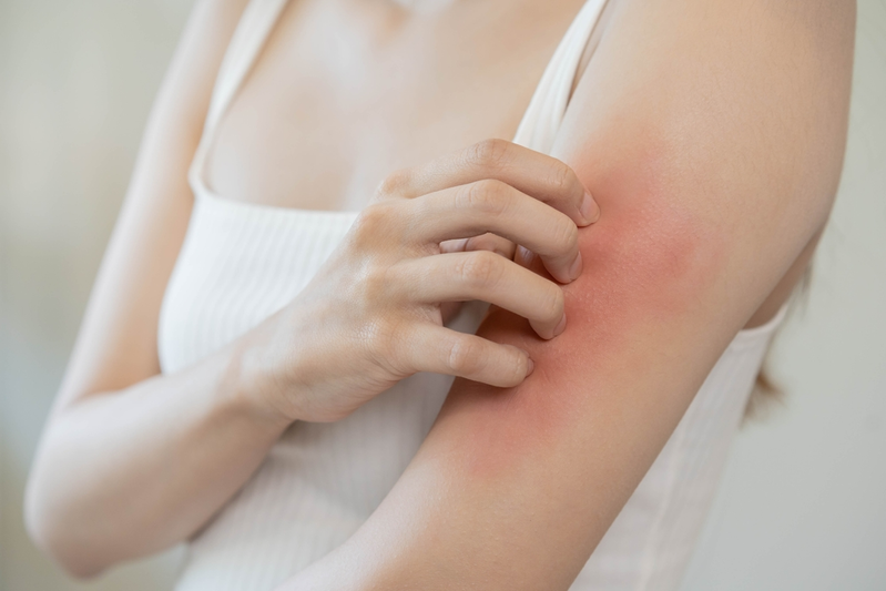 8 Ways to Treat Common Skin Rashes